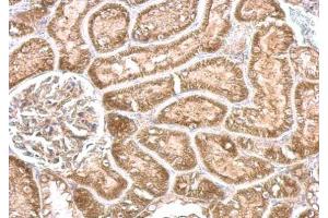 IHC-P Image CYP24A1 antibody detects CYP24A1 protein at cytosol on mouse kidney by immunohistochemical analysis. (CYP24A1 antibody  (Center))