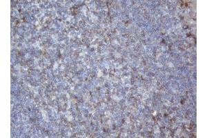 Image no. 1 for anti-Palmitoyl-Protein Thioesterase 1 (PPT1) (AA 100-306) antibody (ABIN1490802) (PPT1 antibody  (AA 100-306))