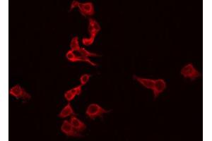 ABIN6272293 staining SKOV3 by IF/ICC. (Ephrin B3 antibody  (Internal Region))