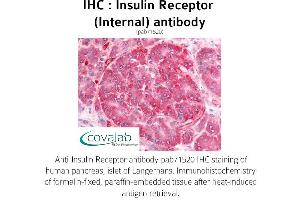 Image no. 1 for anti-Insulin Receptor (INSR) (Internal Region) antibody (ABIN1735948) (Insulin Receptor antibody  (Internal Region))