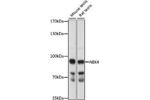 Western blot analysis of extracts of various cell lines, using NEK4 antibody (ABIN7268917) at 1:1000 dilution. (NEK4 antibody  (AA 1-300))