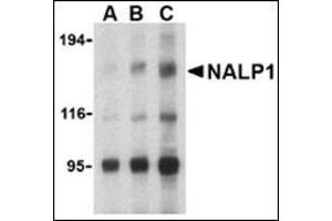 Western blot analysis of NALP1 in U937 cell lysate with this product at (A) 1, (B) 2 and (C) 4 μg/ml.