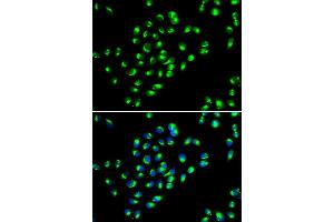 Immunofluorescence analysis of MCF7 cell using GOLM1 antibody. (GOLM1 antibody)