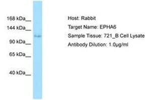 Image no. 1 for anti-EPH Receptor A6 (Epha6) (AA 313-362) antibody (ABIN6749998)
