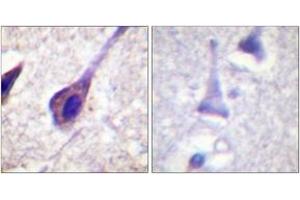 Immunohistochemistry analysis of paraffin-embedded human brain, using BID (Ab-78) Antibody. (BID antibody  (AA 44-93))