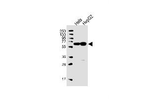 All lanes : Anti-UTP6 Antibody (N-term) at 1:1000 dilution Lane 1: Hela whole cell lysate Lane 2: HepG2 whole cell lysate Lysates/proteins at 20 μg per lane.