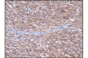 Image no. 1 for anti-Mast/stem Cell Growth Factor Receptor (KIT) (C-Term) antibody (ABIN1493321) (KIT antibody  (C-Term))