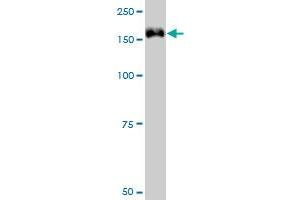 TRIM33 monoclonal antibody (M01), clone 6D1. (TRIM33 antibody  (AA 1006-1105))