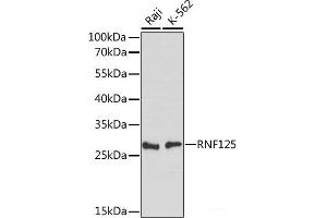 Western blot analysis of extracts of various cell lines using RNF125 Polyclonal Antibody at dilution of 1:1000. (RNF125 antibody)