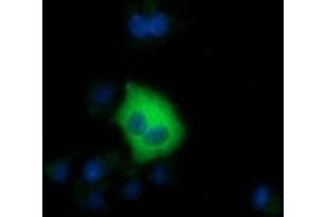 Anti-SDR9C7 mouse monoclonal antibody (ABIN2453633) immunofluorescent staining of COS7 cells transiently transfected by pCMV6-ENTRY SDR9C7 (RC210941). (SDR9C7 antibody)