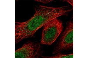 Immunofluorescent staining of human cell line U-2 OS shows positivity in nucleus but not nucleoli. (RPP25 antibody)