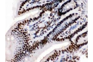 IHC testing of FFPE mouse intestine with TRIM28 antibody. (KAP1 antibody  (AA 699-835))