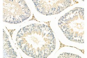 ABIN6264389 and ABIN6279692 at 1/100 staining Rat testis tissue by IHC-P. (PPP1R3D antibody  (Internal Region))