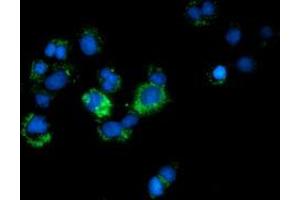 Immunofluorescence (IF) image for anti-Calcium Binding and Coiled-Coil Domain 2 (CALCOCO2) antibody (ABIN1497077) (CALCOCO2 antibody)