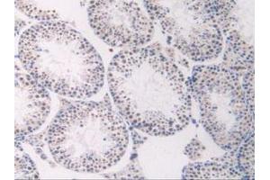 IHC-P analysis of Mouse Testis Tissue, with DAB staining. (FLT1 antibody  (AA 27-329))