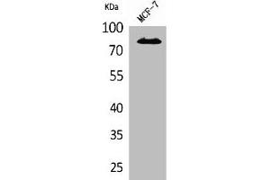 Western Blot analysis of MCF7 cells using IL-1RI Polyclonal Antibody (IL1R1 antibody  (N-Term))