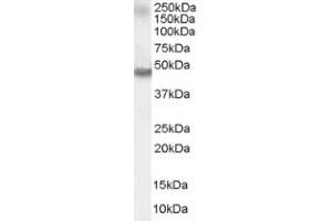 Image no. 1 for anti-Retinoic Acid Receptor, alpha (RARA) (C-Term) antibody (ABIN374531) (Retinoic Acid Receptor alpha antibody  (C-Term))