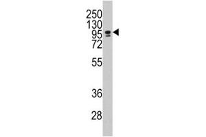 Western blot analysis of CEBPZ / CBF antibody and NCI-H460 lysate. (CEBPZ antibody  (AA 1001-1029))