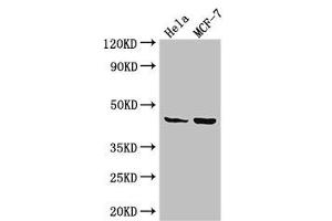 Western Blot Positive WB detected in: Hela whole cell lysate, MCF-7 whole cell lysate All lanes: MAP2K4 antibody at 3. (MAP2K4 antibody  (AA 259-398))