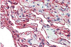Human Lung (formalin-fixed, paraffin-embedded) stained with S100A10 antibody ABIN462133 followed by biotinylated anti-mouse IgG secondary antibody ABIN481714, alkaline phosphatase-streptavidin and chromogen. (S100A10 antibody)