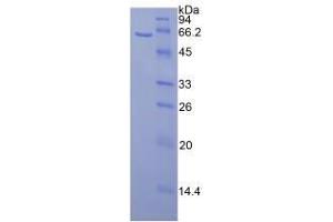 SDS-PAGE analysis of Mouse Calbindin Protein.