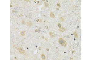 SLC2A13 antibody