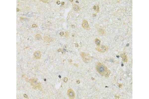 SLC2A13 antibody