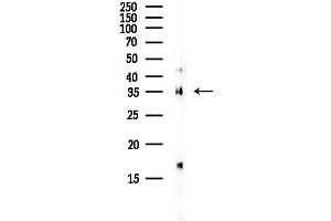 anti-F11 Receptor (F11R) (C-Term) antibody