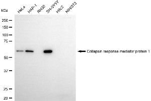 Western blotting analysis using collapsin response mediator protein 1 antibody (ABIN7798129).