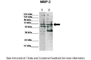 Lanes:   Lane 1: 15ug MDA-MB-231 lysate Lane 2: 15ug MCF7 lysate  Primary Antibody Dilution:    1:1000  Secondary Antibody:   Anti-rabbit-HRP  Secondary Antibody Dilution:    1:10,000  Gene Name:   MMP2  Submitted by:   Katarzyna Augoff, University of Wroclaw (MMP2 antibody  (C-Term))