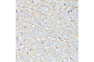 Immunohistochemistry of paraffin-embedded rat liver using CTNN antibody (ABIN7266134) at dilution of 1:100 (40x lens). (CTNNA2 antibody  (AA 150-300))