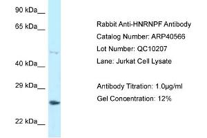 WB Suggested Anti-HNRNPF Antibody   Titration: 1. (HNRNPF antibody  (C-Term))