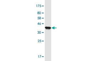 Western Blot detection against Immunogen (36. (MLXIP antibody  (AA 481-577))