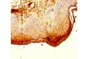 Immunohistochemistry of paraffin-embedded human skin tissue using ABIN7150586 at dilution of 1:100 (ALG12 antibody  (AA 367-422))