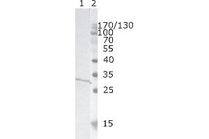 Western Blot testing of HIV-1 recombinant Nef protein. (HIV-1 Nef (AA 31-35) antibody)