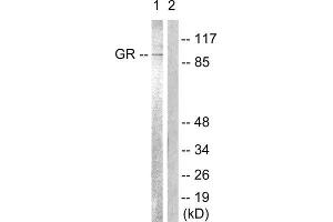 Western Blotting (WB) image for anti-GR (Internal Region), (pSer234), (Ser226), (Ser246) antibody (ABIN1847938) (GR (Internal Region), (pSer234), (Ser226), (Ser246) antibody)