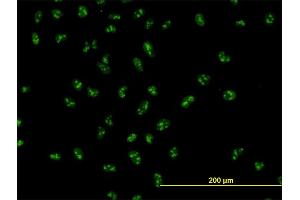 Immunofluorescence of monoclonal antibody to UBTF on HeLa cell.