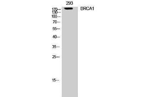 Western Blotting (WB) image for anti-Breast Cancer 1 (BRCA1) (Ser182) antibody (ABIN3174053) (BRCA1 antibody  (Ser182))