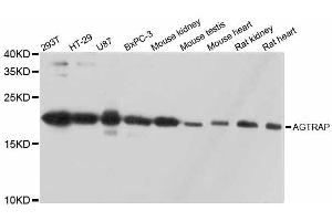 Western blot analysis of extracts of various cell lines, using AGTRAP antibody. (AGTRAP antibody  (AA 93-152))