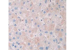 Used in DAB staining on fromalin fixed paraffin- embedded liver tissue (TSTA3 antibody  (AA 1-321))