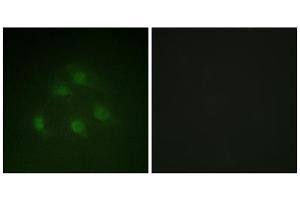 Immunofluorescence analysis of HeLa cells, using Smad1 (epitope around residue 187) antibody. (SMAD1 antibody  (Ser187))