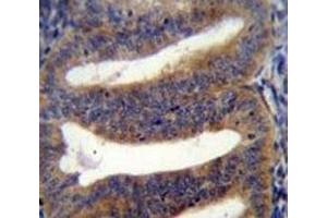 RBPMS2 antibody immunohistochemistry analysis in formalin fixed and paraffin embedded human uterus tissue. (RBPMS2 antibody  (AA 113-141))
