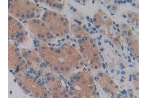 #VALUE! (Vascular Endothelial Growth Factor 145 (AA 28-147) antibody)