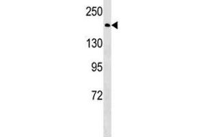 BRCA1 antibody western blot analysis in HeLa lysate. (BRCA1 antibody  (AA 443-472))