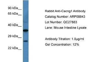 WB Suggested Anti-Cacng1  Antibody Titration: 0. (CACNG1 antibody  (N-Term))