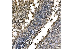 IHC analysis of WAPL/FOE using anti-WAPL/FOE antibody (ABIN7602663).