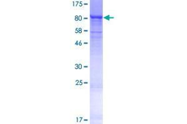 ZNF416 Protein (AA 1-594) (GST tag)