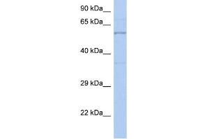 WB Suggested Anti-TH Antibody Titration: 0. (TH antibody  (N-Term))