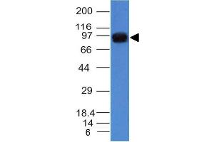 Western Blot of A431 cell lysate using Nucleolin Mouse Monoclonal Antibody (NCL/902). (Nucleolin antibody)