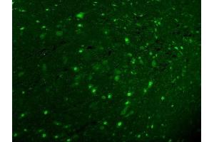 IF analysis of Calbindin using anti-Calbindin antibody (ABIN6719541). (CALB1 antibody  (AA 2-261))